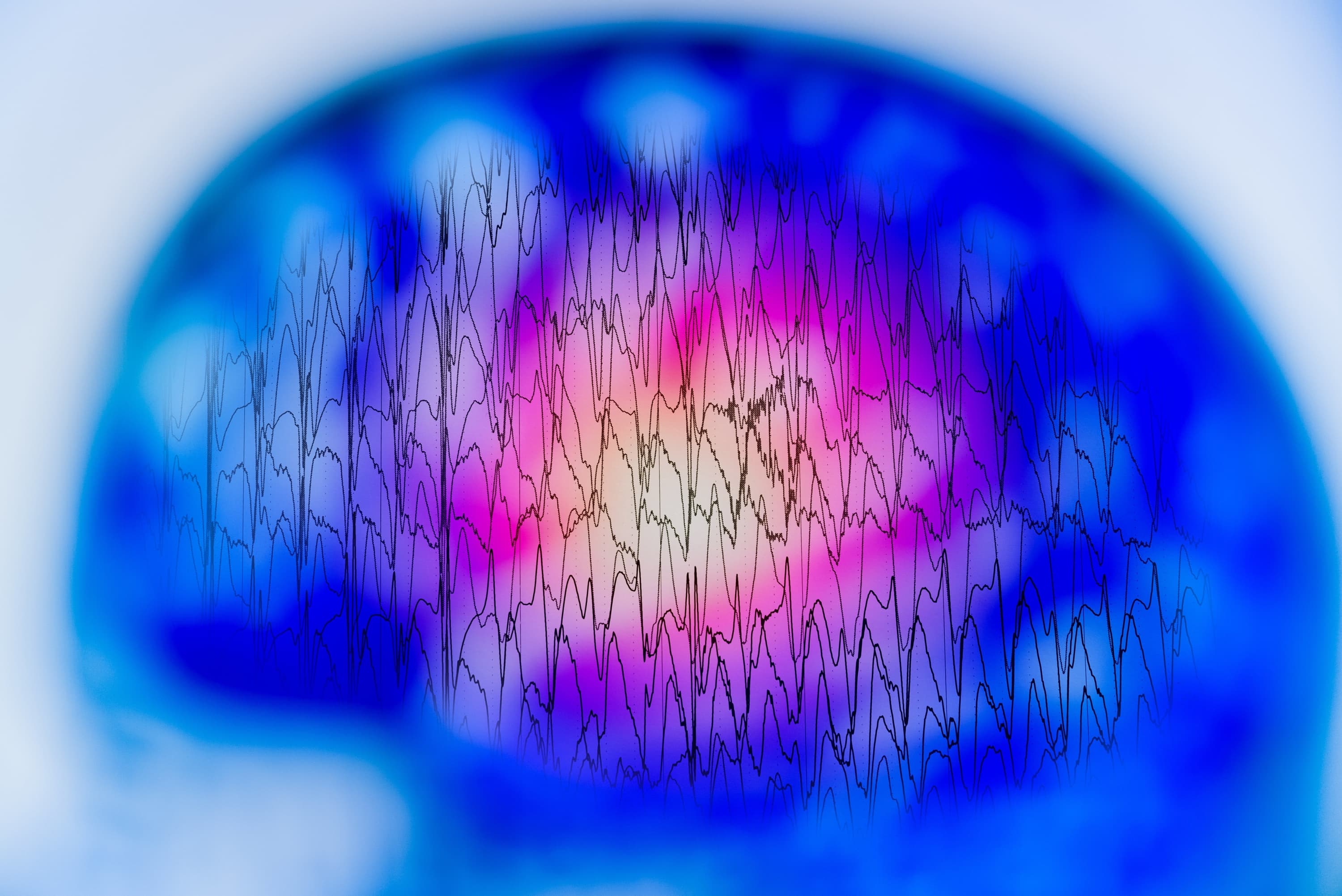 Brain with radio waves on top of it
